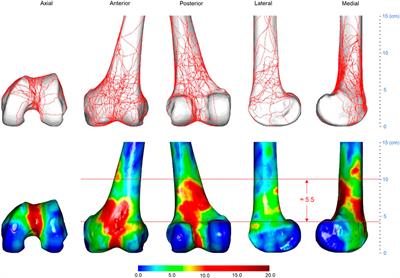 Three-dimensional computed tomography mapping techniques in the morphometric analysis of AO/OTA 33A and 33C distal femoral fractures: a retrospective single-center study